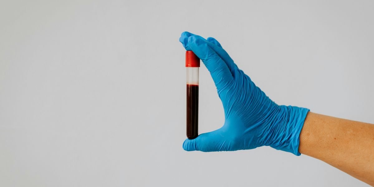 The Health Crisis Hiding in Plain Sight: How Eyenaemia is Addressing the Innovation in Anemia Detection
